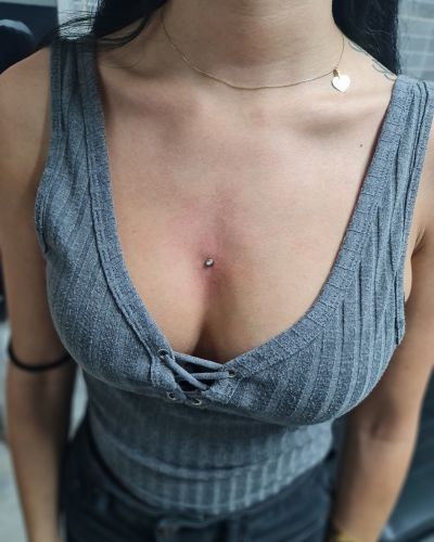 Dermal Anchor